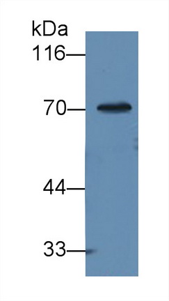 Monoclonal Antibody to Alpha-1-B-Glycoprotein (a1BG)