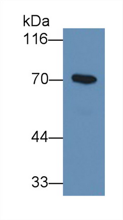 Monoclonal Antibody to Alpha-1-B-Glycoprotein (a1BG)