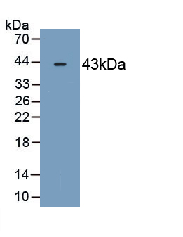 Monoclonal Antibody to 2',5'-Oligoadenylate Synthetase 2 (OAS2)