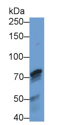 Monoclonal Antibody to Peptidyl Arginine Deiminase Type IV (PADI4)