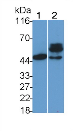 Monoclonal Antibody to Phosphatase And Tensin Homolog (PTEN)