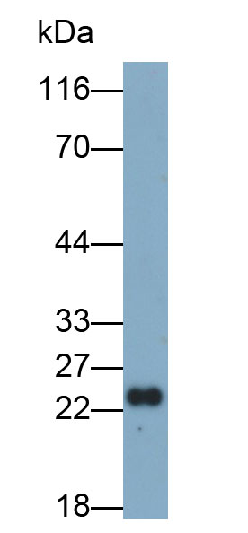 Monoclonal Antibody to Stathmin 2 (STMN2)