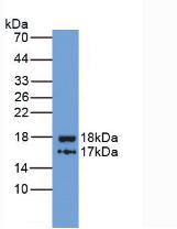 Monoclonal Antibody to Inter Alpha-Globulin Inhibitor H4 (ITIH4)