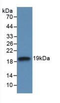 Monoclonal Antibody to Interleukin 18 Binding Protein (IL18BP)