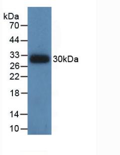 Monoclonal Antibody to Isocitrate Dehydrogenase 1, Soluble (IDH1)