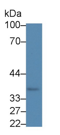 Monoclonal Antibody to Gamma-Glutamyl Hydrolase (gGH)