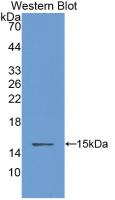 Monoclonal Antibody to Cystatin B (CSTB)