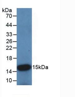 Monoclonal Antibody to Cystatin B (CSTB)