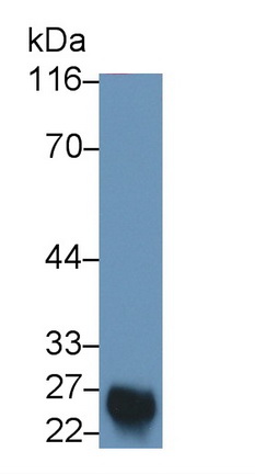 Monoclonal Antibody to Catechol-O-Methyltransferase (COMT)