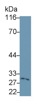 Monoclonal Antibody to Catechol-O-Methyltransferase (COMT)