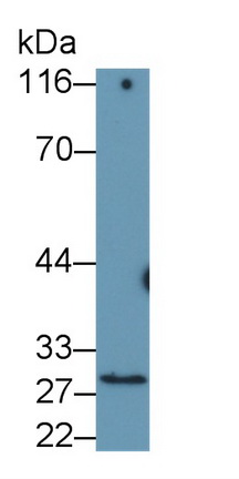 Monoclonal Antibody to Catechol-O-Methyltransferase (COMT)