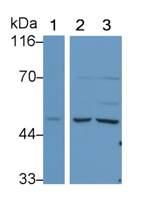 Monoclonal Antibody to Lecithin Cholesterol Acyltransferase (LCAT)