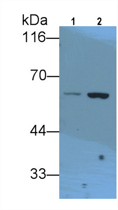 Monoclonal Antibody to Lecithin Cholesterol Acyltransferase (LCAT)