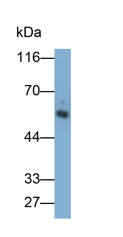Monoclonal Antibody to Lecithin Cholesterol Acyltransferase (LCAT)