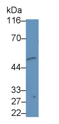 Monoclonal Antibody to Beta-1,4-N-Acetyl Galactosaminyl Transferase 2 (b4GALNT2)