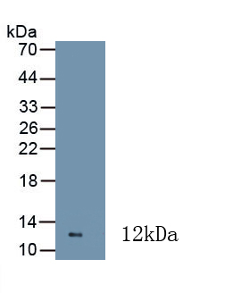 Monoclonal Antibody to Calprotectin (CALPRO)