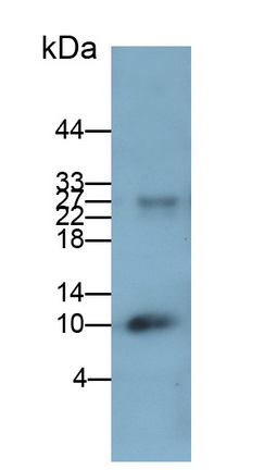 Monoclonal Antibody to Calprotectin (CALPRO)