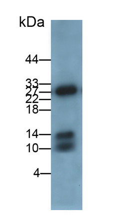 Monoclonal Antibody to Calprotectin (CALPRO)