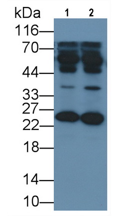 Monoclonal Antibody to Parkinson Disease Protein 7 (PARK7)