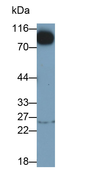 Monoclonal Antibody to Wolfram Syndrome Protein 1 (WFS1)