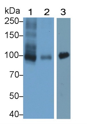 Monoclonal Antibody to Wolfram Syndrome Protein 1 (WFS1)