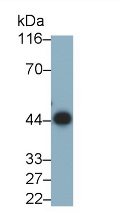 Monoclonal Antibody to Alpha-2-Glycoprotein 1, Zinc Binding (aZGP1)