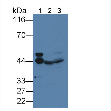 Monoclonal Antibody to Alpha-2-Glycoprotein 1, Zinc Binding (aZGP1)