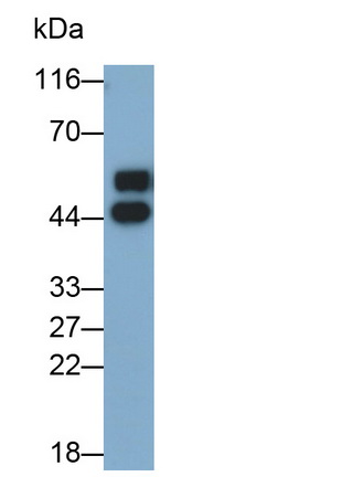 Monoclonal Antibody to Alpha-2-Glycoprotein 1, Zinc Binding (aZGP1)