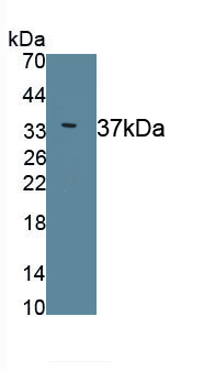 Monoclonal Antibody to Endoplasmic Reticulum Lipid Raft Associated Protein 2 (ERLIN2)