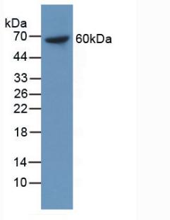 Monoclonal Antibody to Metastasis Associated In Colon Cancer 1 (MACC1)