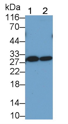 Monoclonal Antibody to T-Cell Immunoreceptor With Ig And ITIM Domains Protein (TIGIT)