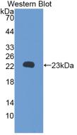 Monoclonal Antibody to Retinol Binding Protein 5, Cellular (RBP5)