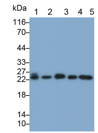 Monoclonal Antibody to Proteasome 26S Subunit, Non ATPase 10 (PSMD10)