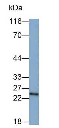 Monoclonal Antibody to Proteasome 26S Subunit, Non ATPase 10 (PSMD10)