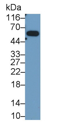 Monoclonal Antibody to Glioblastoma Expressed Ring Finger Protein (GERP)