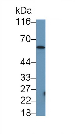 Monoclonal Antibody to Glioblastoma Expressed Ring Finger Protein (GERP)