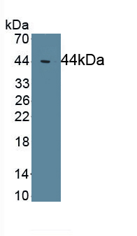 Monoclonal Antibody to Complement Component 4d (C4d)