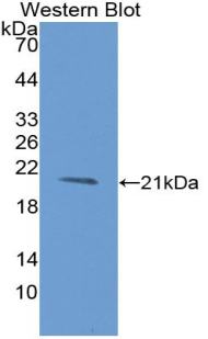 Monoclonal Antibody to Vascular Endothelial Growth Factor 145 (VEGF145)