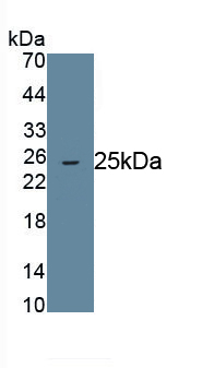 Monoclonal Antibody to Angiopoietin Like Protein 8 (ANGPTL8)