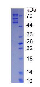 Native Fibrinogen (FG)