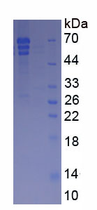 Native Fibrinogen (FG)