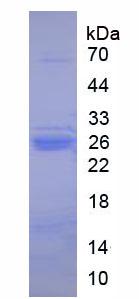 Native Trypsin (TRY)