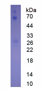 Native Immunoglobulin A (IgA)