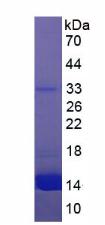 Native Hemoglobin (HB)