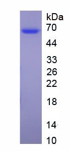 Native Antithrombin (AT)