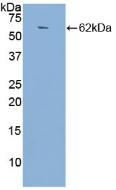 Polyclonal Antibody to Angiotensin I Converting Enzyme (ACE)