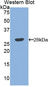 Polyclonal Antibody to Angiopoietin 1 (ANGPT1)