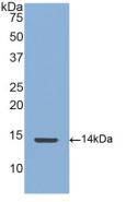 Polyclonal Antibody to Connective Tissue Growth Factor (CTGF)