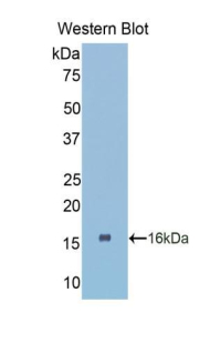 Polyclonal Antibody to Connective Tissue Growth Factor (CTGF)