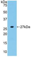 Polyclonal Antibody to Connective Tissue Growth Factor (CTGF)